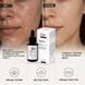 Пилинг SKIN FICTION против несовершенств с активированным углём, AHA-, BHA-кислотами и экстрактом комбучи 4820297970338 фото 4