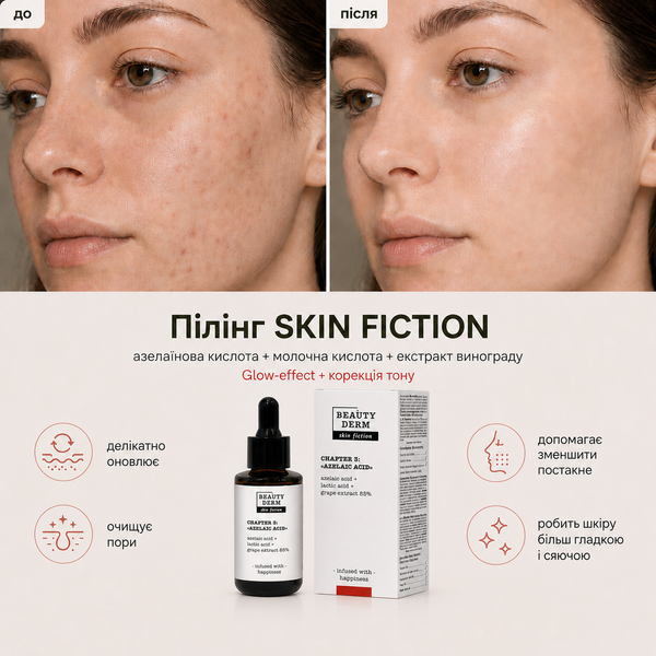 SKIN FICTION Peel with Azelaic & Lactic Acids and Grape Extract